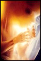 2_FETO DIA088-1